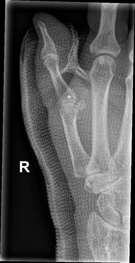 Hand – Sportarzt Dr. Philipp Schultes